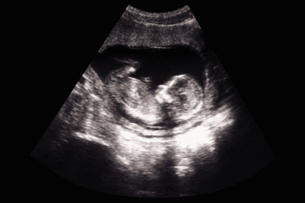 A Black And White Sonograph Of An Unborn Baby For Ultrasound Technician'S Salary In Canada